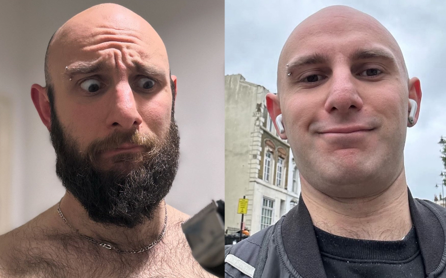 Before and after of a bearded and clean shaven man.