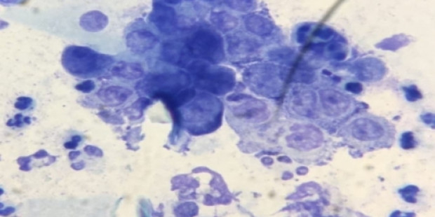 Chlamydia Chlamydia