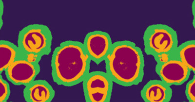 gonorrhoea cells