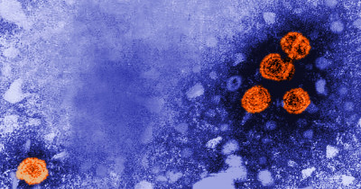 Microscopic image of Hepatitis B