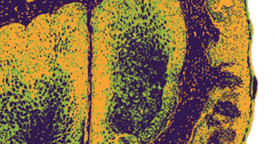 Microscopic image of molluscum