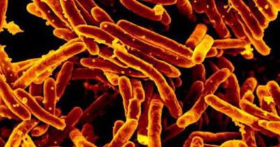 Microscopic photo of TB