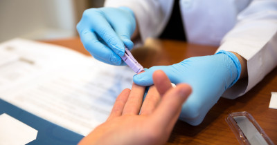 HIV fingerprick test A person having a fingerprick test.