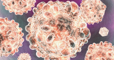Hepatitis C Hepatitis C