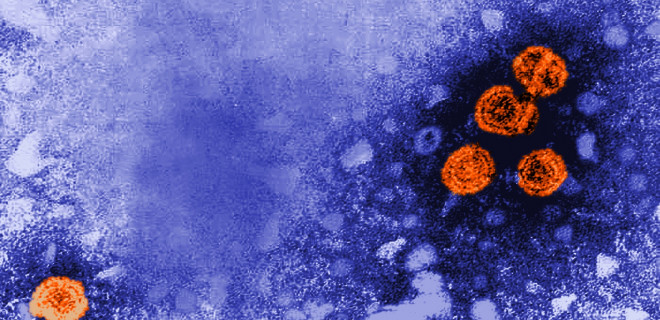 Microscopic image of Hepatitis B