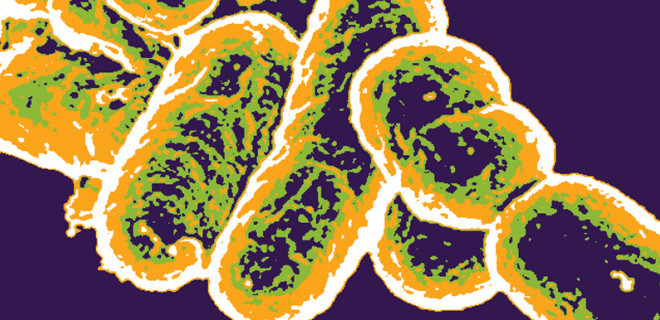 Microscopic image of shigella