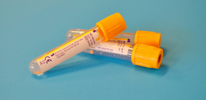 A set of closed vials.