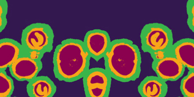 gonorrhoea cells