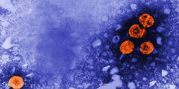 Microscopic image of Hepatitis B
